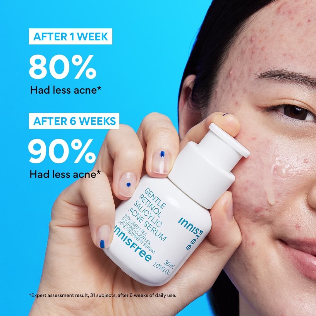 gentle retinol acne serum claims