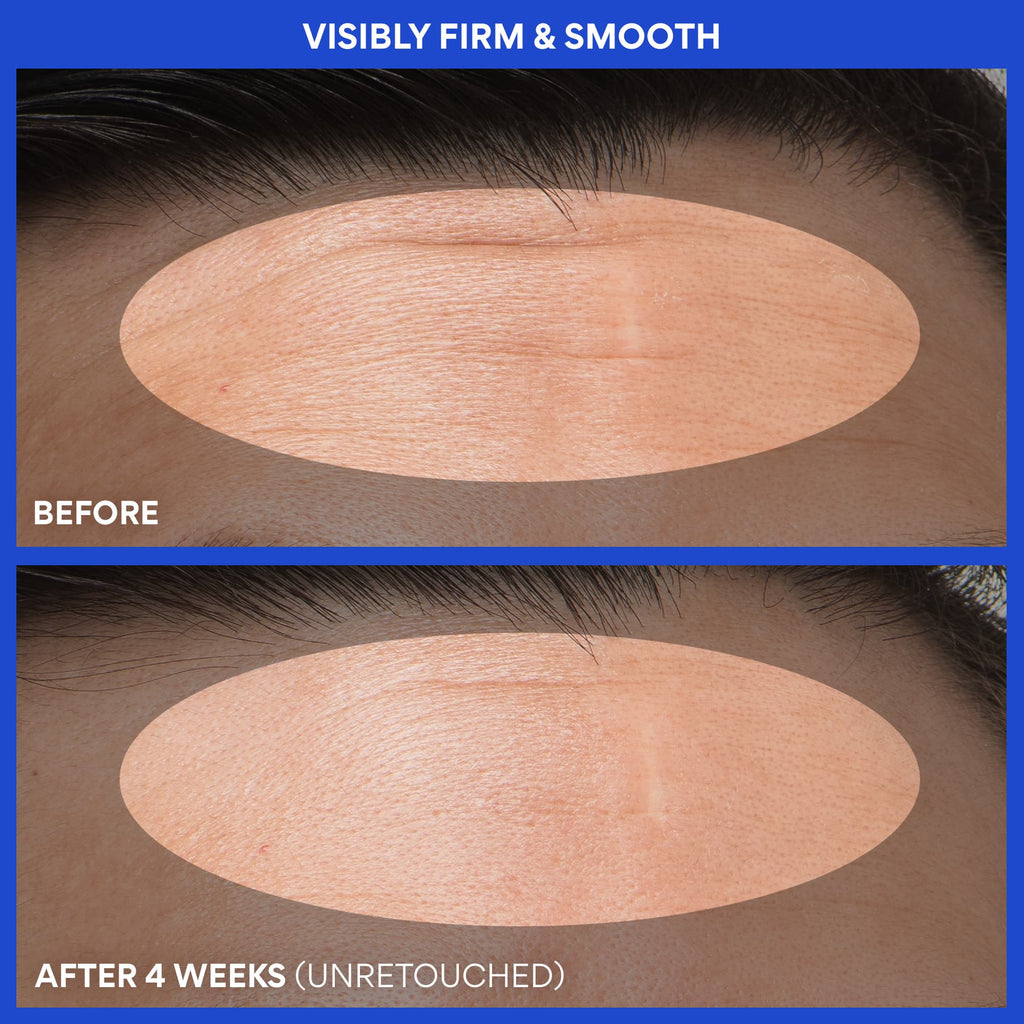 Retinol Green Tea PDRN™ Firming Serum before and after