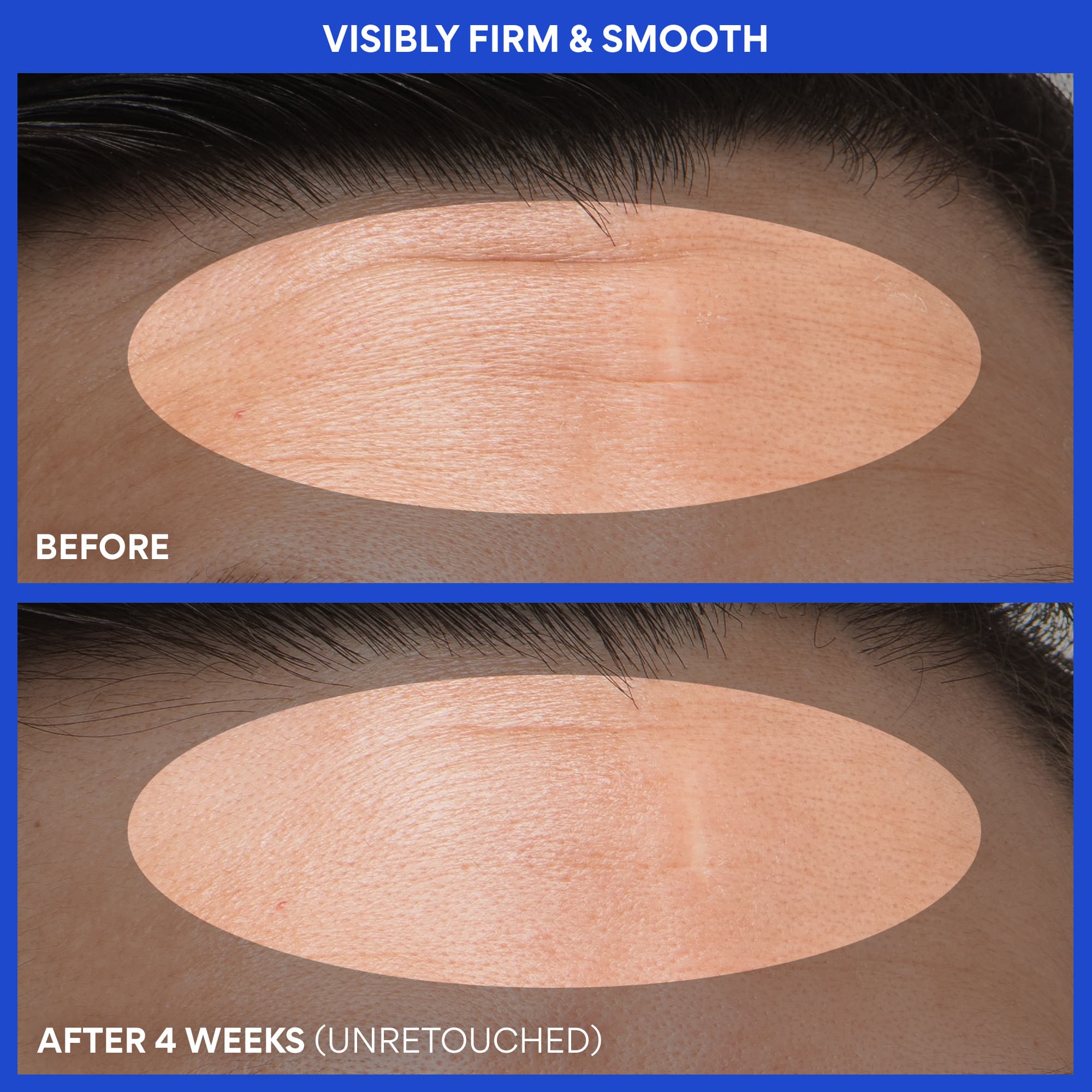 Retinol Green Tea PDRN™ Firming Serum before and after