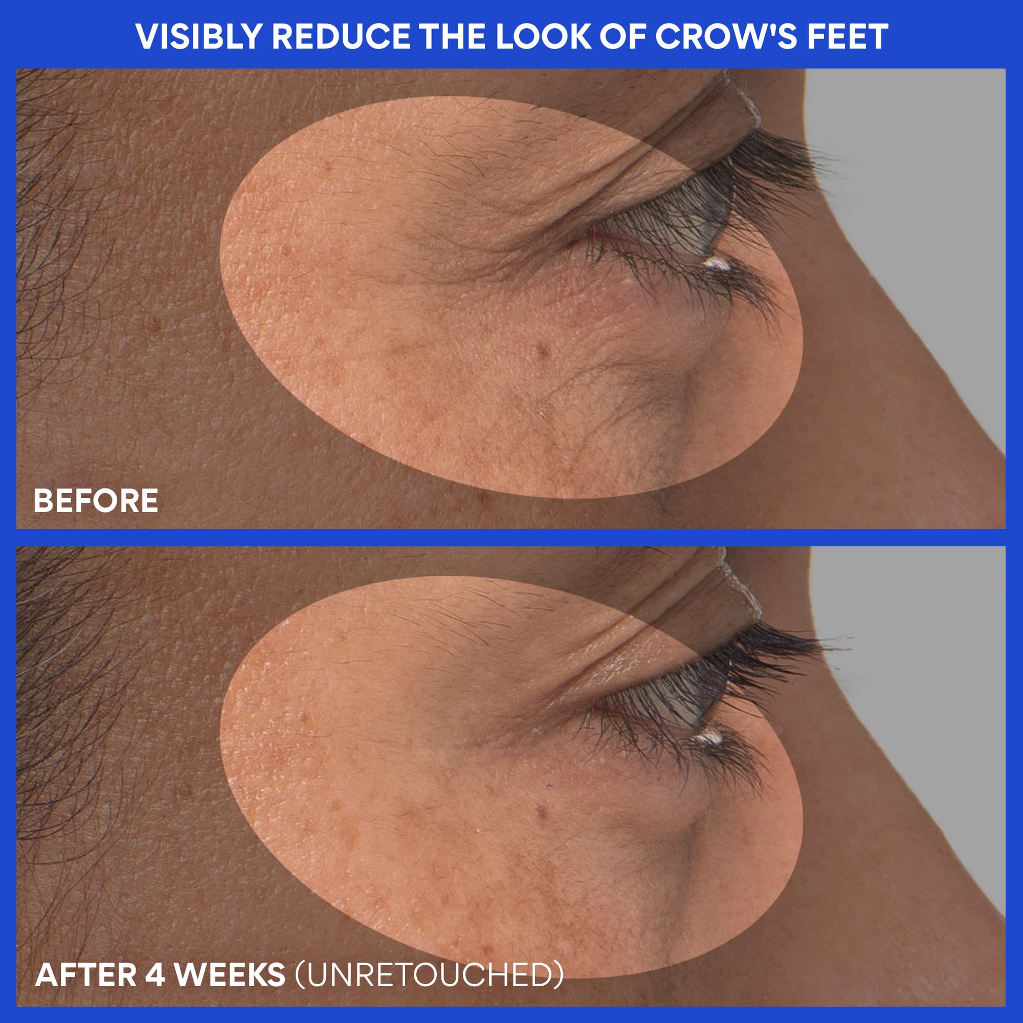 Retinol Green Tea PDRN™ Firming Serum before and after