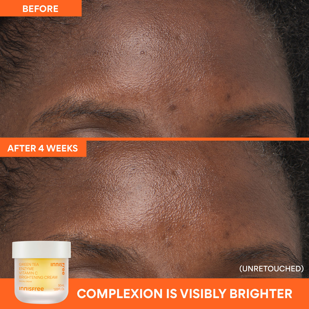 complexion is visibly brighter before and after vitamin c gel cream