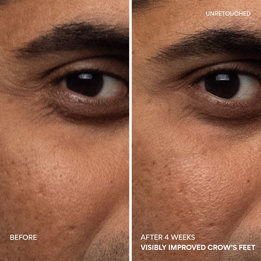 Green Tea PDRN™ Bounce Booster Eye & Lip Serum crow's feet before and after