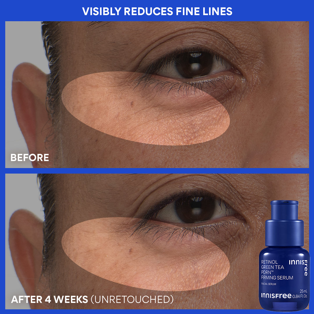 visibly reduces fine lines before and after for Green Tea PDRN™ Serum