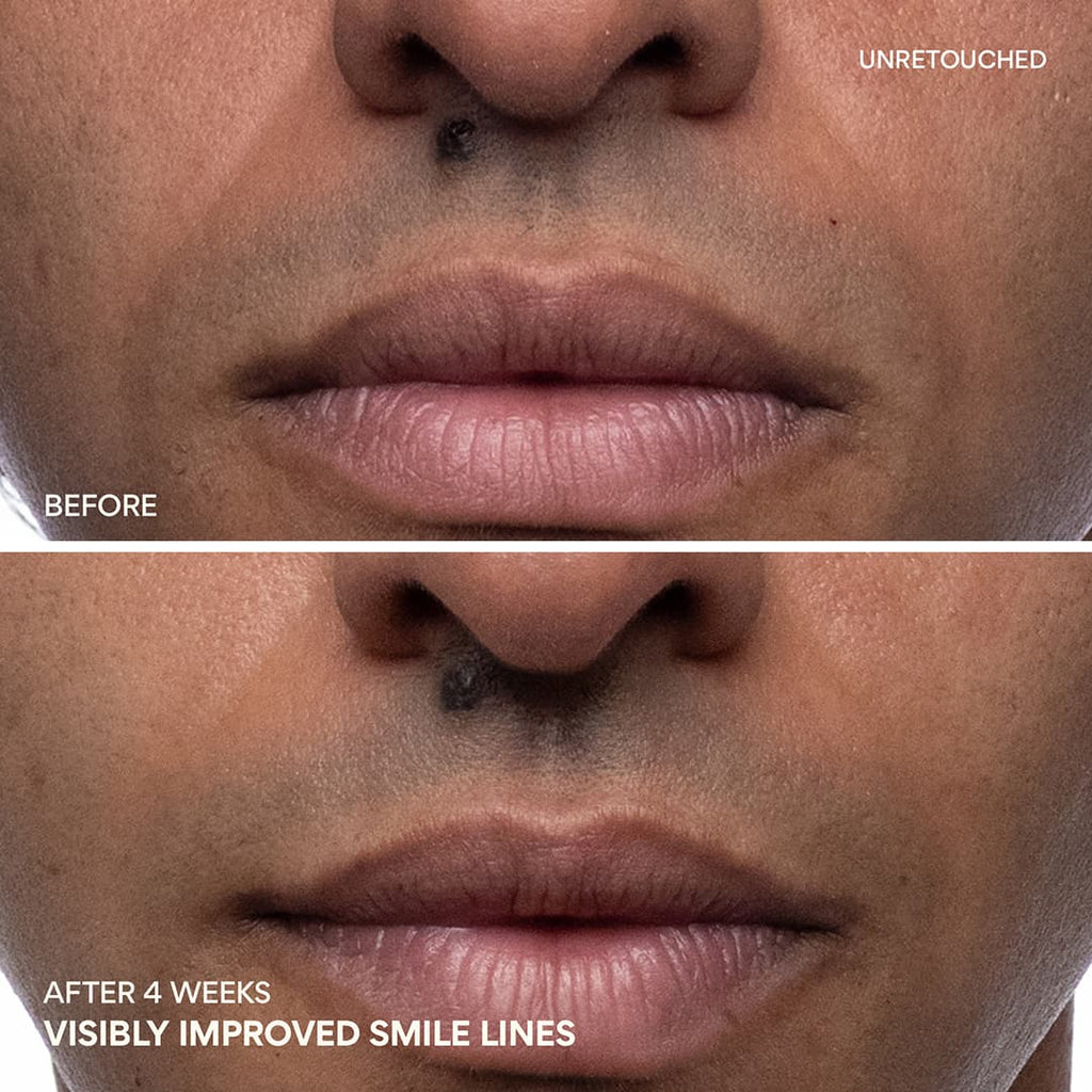 Green Tea PDRN™ Bounce Booster Eye & Lip Serum nasolabial folds before and after