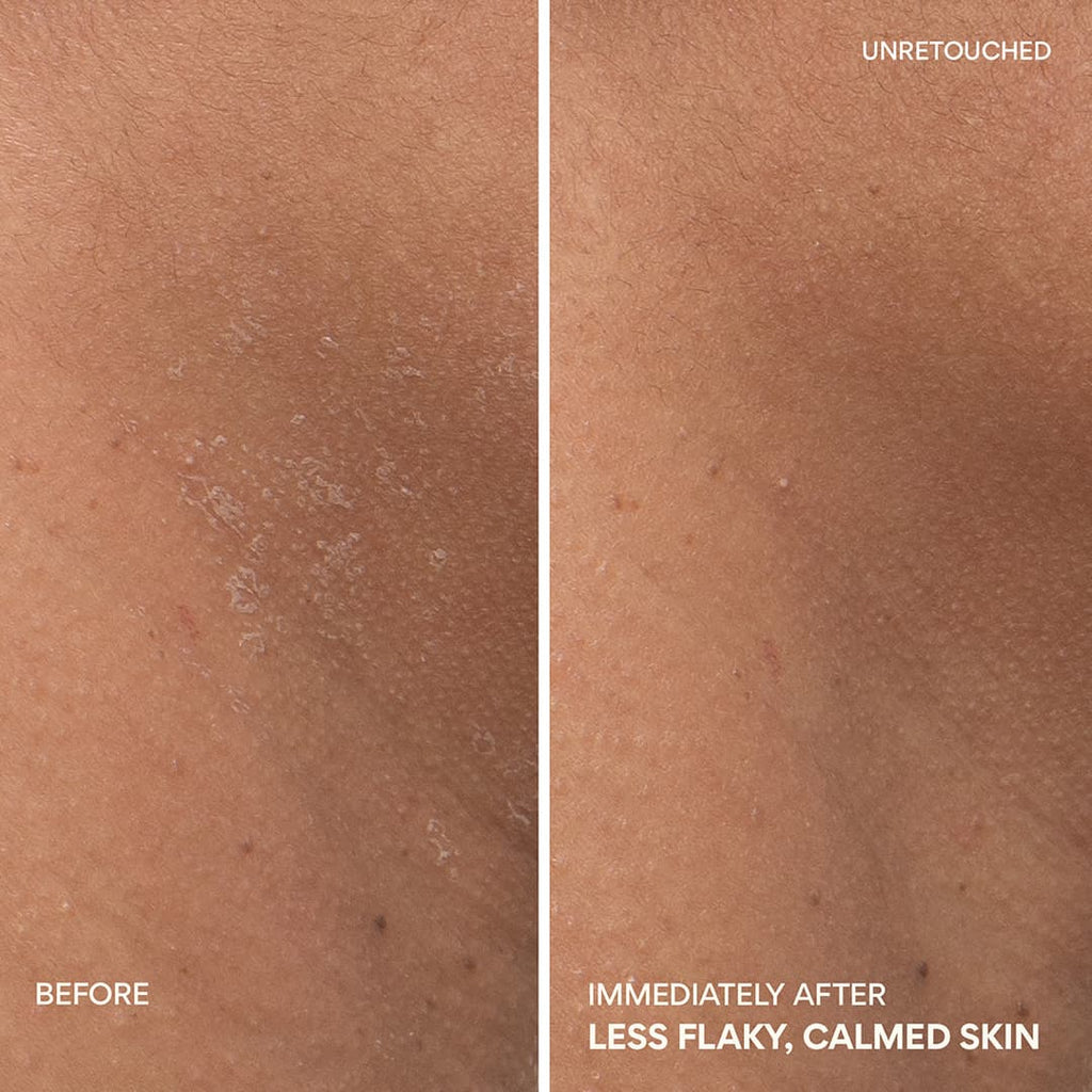 Green Tea Ceramide Cream gives less flaky and calmed skin immediately after using it