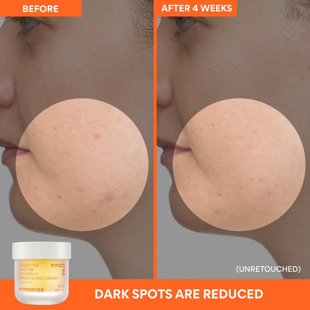 dark spots are reduce before and after 4 weeks: Vitamin C Brightening Gel Cream