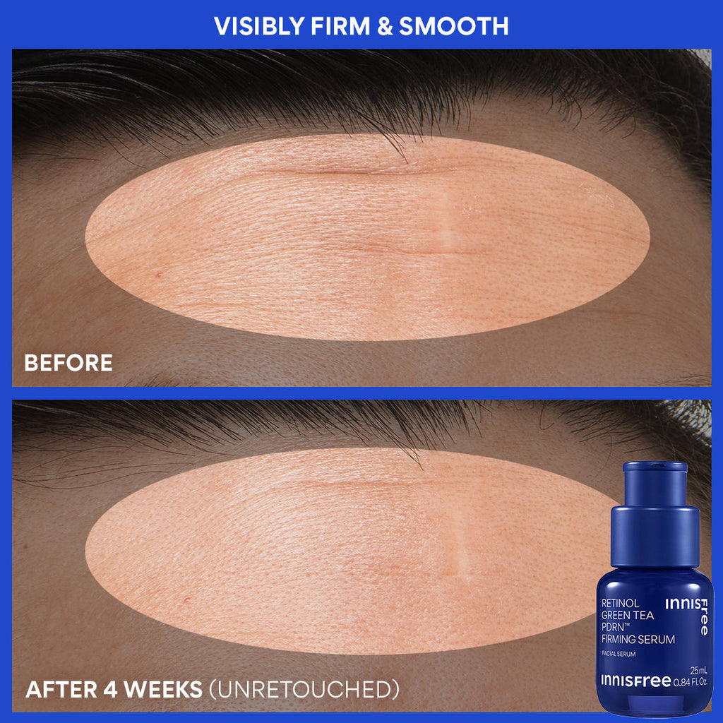 visibly firm and smooth before and after Green Tea PDRN™ Serum