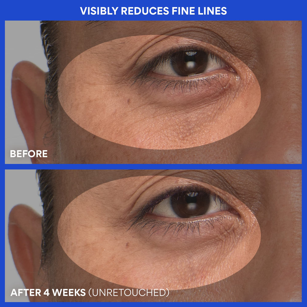Retinol Green Tea PDRN™ Firming Serum before and after