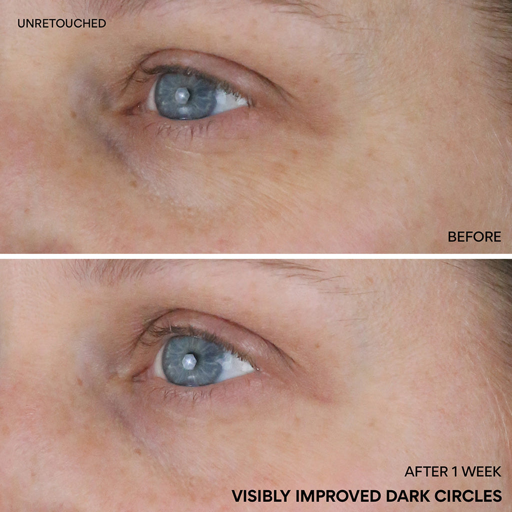 Vitamin C Niacinamide Brightening Eye Serum before and after one week visibly improved dark circles
