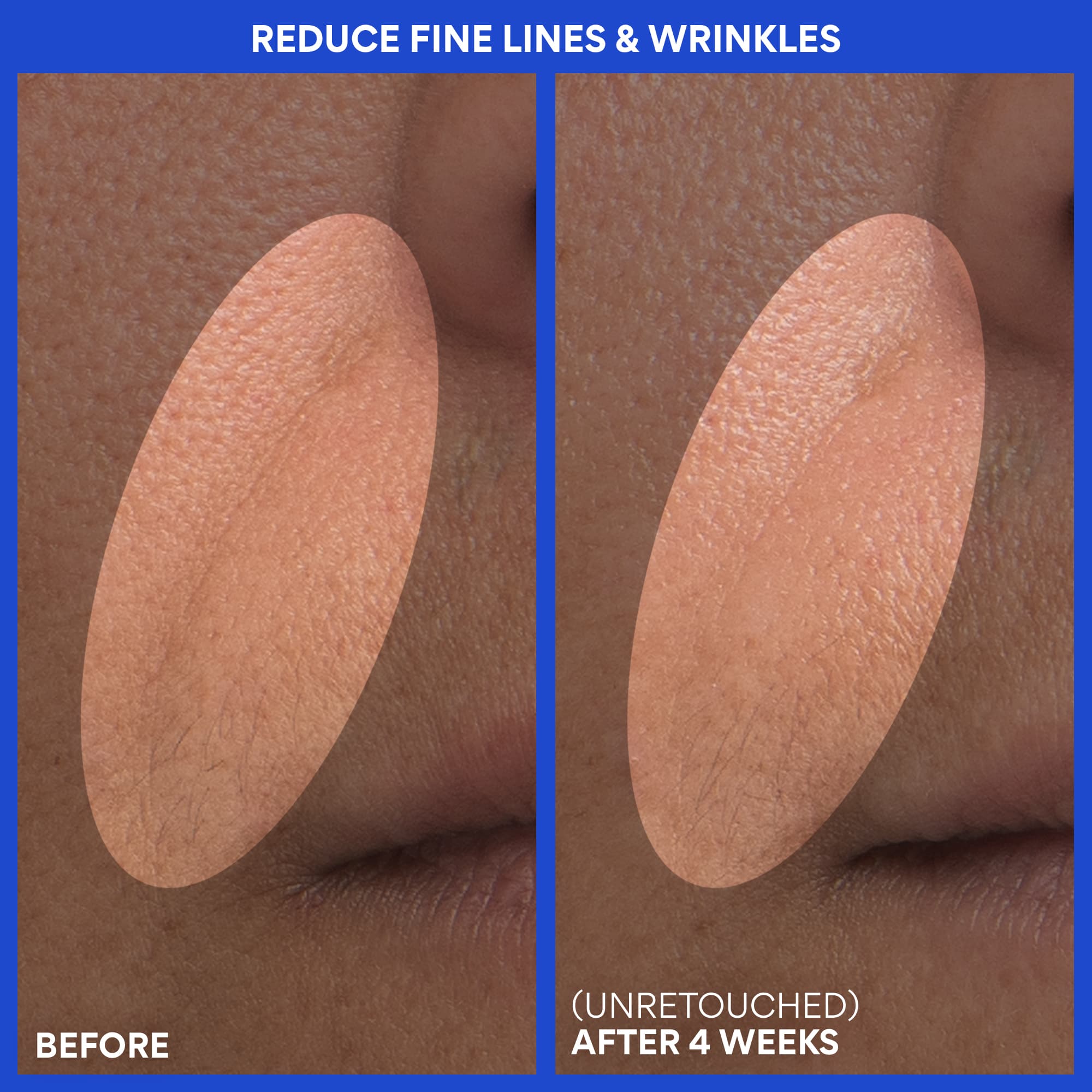 Retinol Green Tea PDRN™ Firming Serum before and after